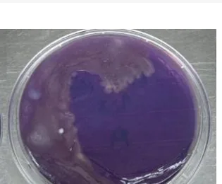 Amostra microbiológica de cortina hospitalar, leito de isolamento, pós-limpeza
