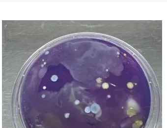 Amostra microbiológica de cortina hospitalar, leito de isolamento, pós-limpeza